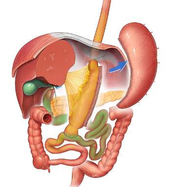 Atlas Of Bariatric and Metabolic Surgery Image
